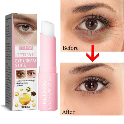 Retinol Eye Moisturizing Stick Instant Reduce Dark Circles Beauty Eye Care