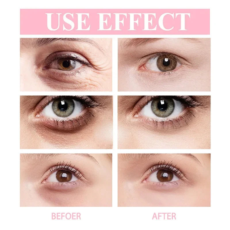 Retinol Eye Moisturizing Stick Instant Reduce Dark Circles Beauty Eye Care