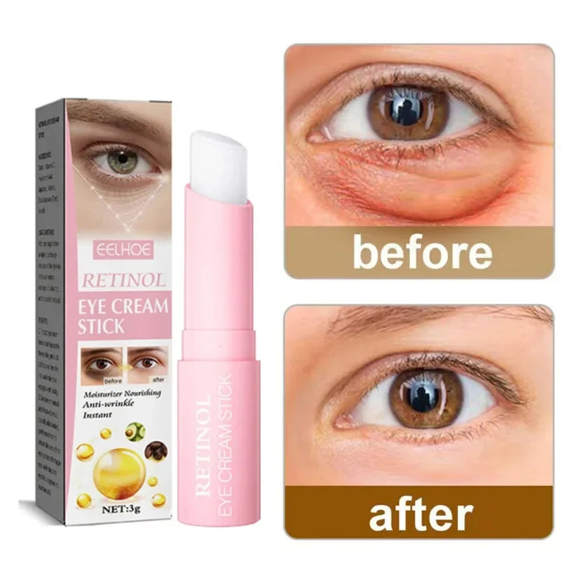 Retinol Eye Moisturizing Stick Instant Reduce Dark Circles Beauty Eye Care