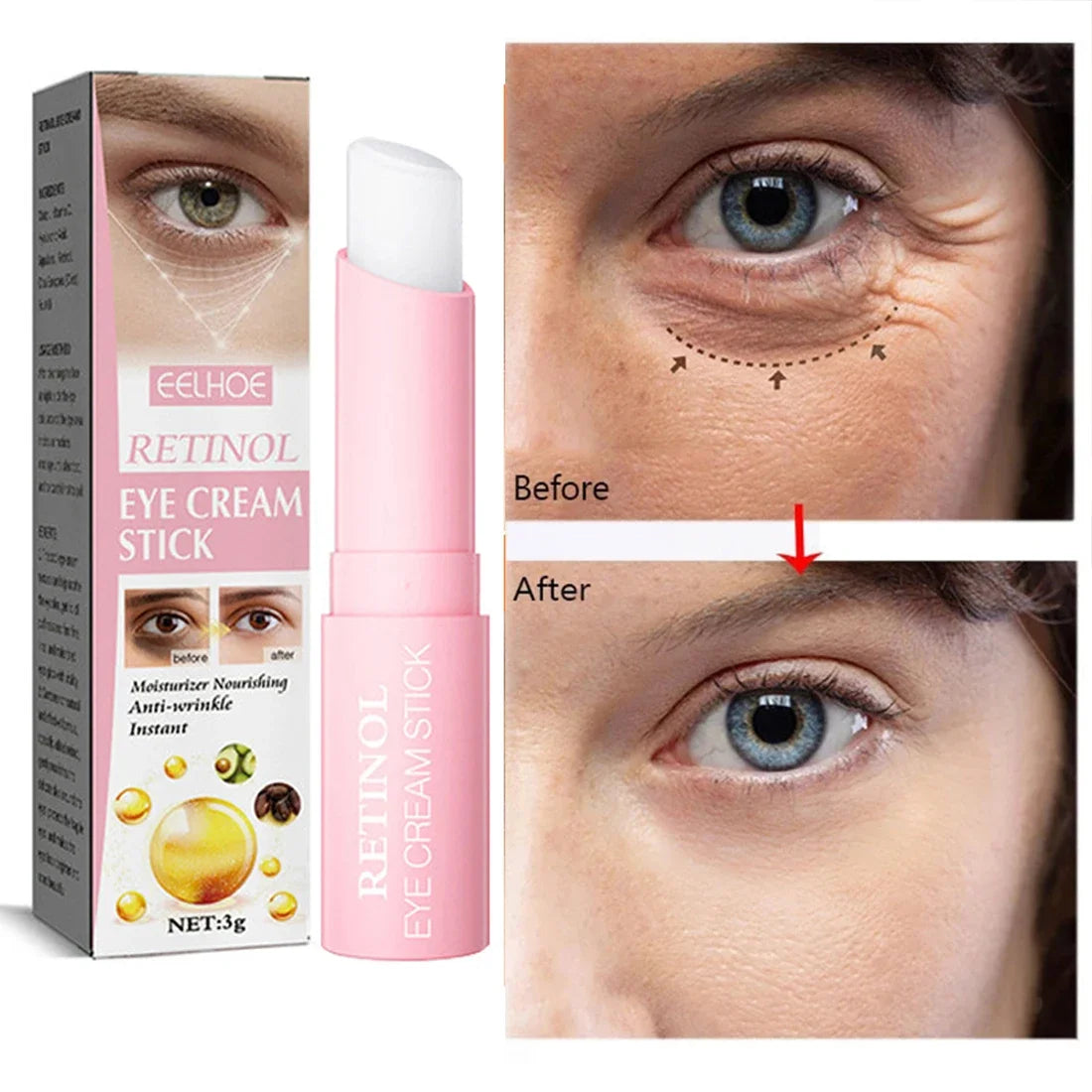 Retinol Eye Moisturizing Stick Instant Reduce Dark Circles Beauty Eye Care